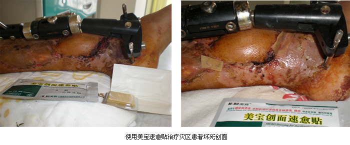 首页|bwin必赢亚洲集团中国官方网站